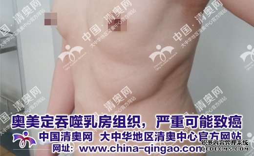 奥美定取出危害